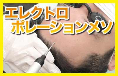 〈ノーダウンタイム〉微弱な電流で発毛成分を浸透させる治療